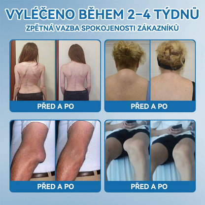 𝑃𝒊𝒄𝐝𝐨® 𝐵𝐏𝑪-157 𝐾𝑟é𝒎 𝒏𝒂 𝒐𝒑𝒓𝑎𝐯𝐮 𝐤𝐥𝐨𝑢𝑏ů 🦴𝑳éčí 𝒂𝒓𝒕𝒓𝒊𝒕𝒊𝒅𝒖,  𝐧𝐞𝐮𝐫𝐨𝐩𝐚𝐭𝐢𝐞, 𝐫𝐞𝐯𝐦𝐚𝐭𝐢𝐬𝐦𝐮𝐬,𝒔𝒑𝒐𝒓𝒕𝒐𝒗𝒏í 𝒛𝒓𝒂𝒏ě𝒏í 𝒂 𝒅𝒂𝒍ší🍀