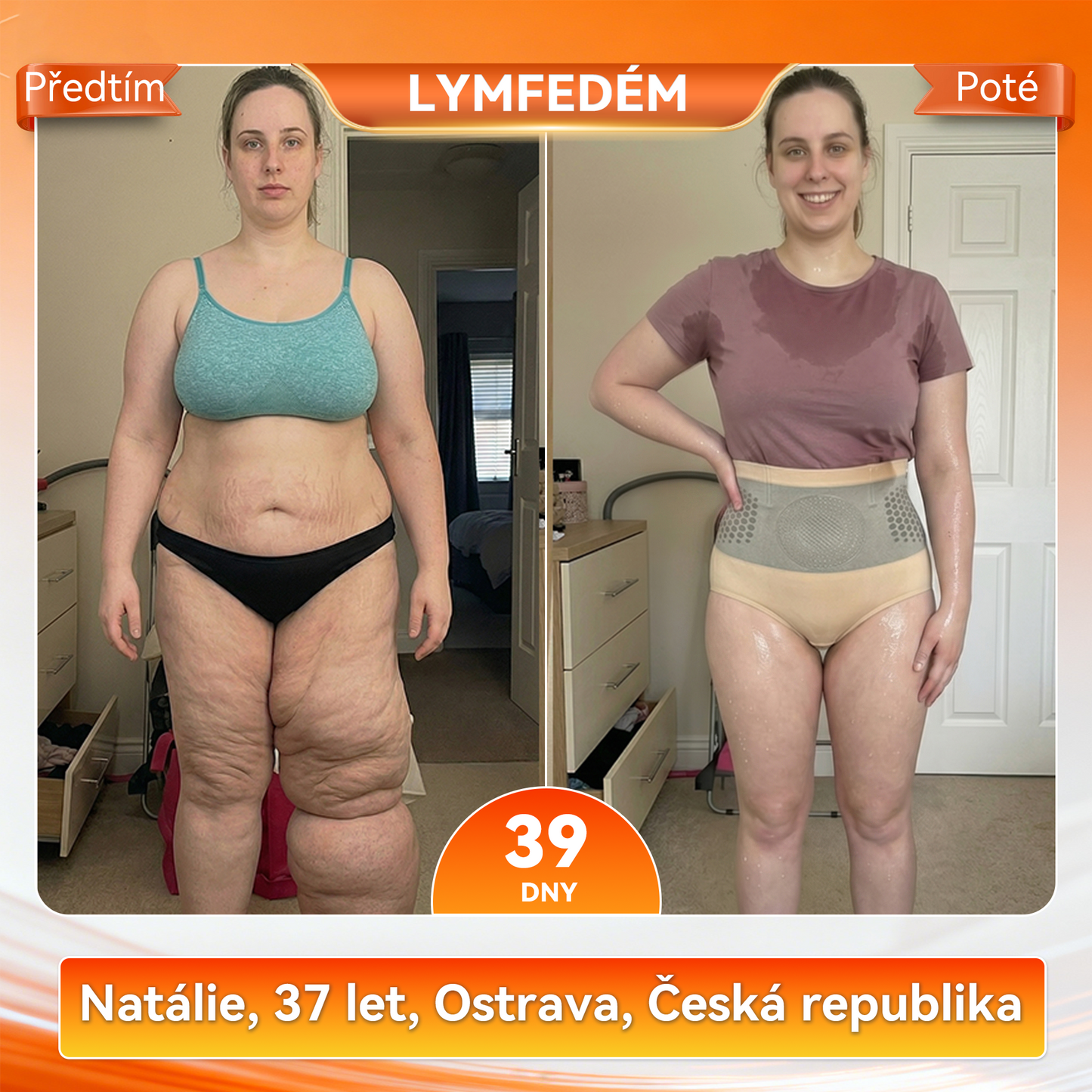 【Časově omezená akce –80%🎁】𝑷𝑨𝑈𝑅𝑨𝑱𝑼® MORINGA A BERBERIN 4v1 MIROČÁSTICOVÉ TVARAJÍCÍ A TUK SPALUJÍCÍ KRÁTKÉ KALHOTY🌿