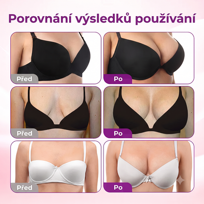 Turonu® Pokročilá nano-mikrojehličková náplast pro cílené zvětšení prsou 🥇