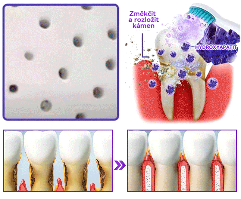𝑫𝒐𝒓𝒎𝒐𝒓𝒏𝒂® Hydroxyapatit Zub Oprava Prášek✅Účinně léčí zubní kaz, problémy s dásněmi, citlivé zuby, afty a žluté zuby, zároveň zlepšuje celkové ústní zdraví.💎