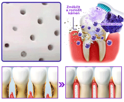 𝑫𝒐𝒓𝒎𝒐𝒓𝒏𝒂® Hydroxyapatit Zub Oprava Prášek✅Účinně léčí zubní kaz, problémy s dásněmi, citlivé zuby, afty a žluté zuby, zároveň zlepšuje celkové ústní zdraví.💎