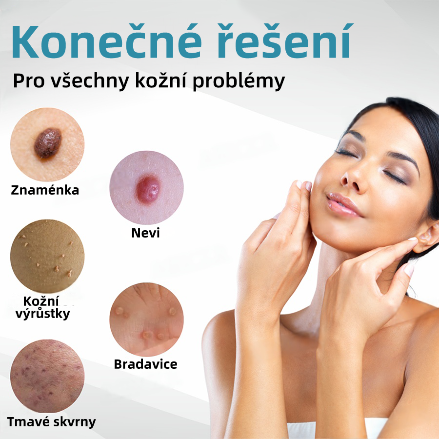 KIDSNEED® Neinvazivní laserové pero na odstranění bradavic a znamének - silně Recommended by the Czech Dermatovenerological Society (ČDS)🔥