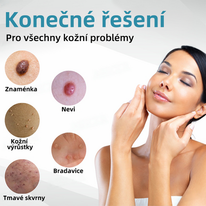 KIDSNEED® Neinvazivní laserové pero na odstranění bradavic a znamének - silně Recommended by the Czech Dermatovenerological Society (ČDS)🔥