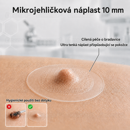 𝐄𝐦𝐞𝐦𝐚𝐱® 2v1 mikrojádrová a hydrokoloidní náplast na odstranění znamének (bez bolesti, bez jizev)🍁