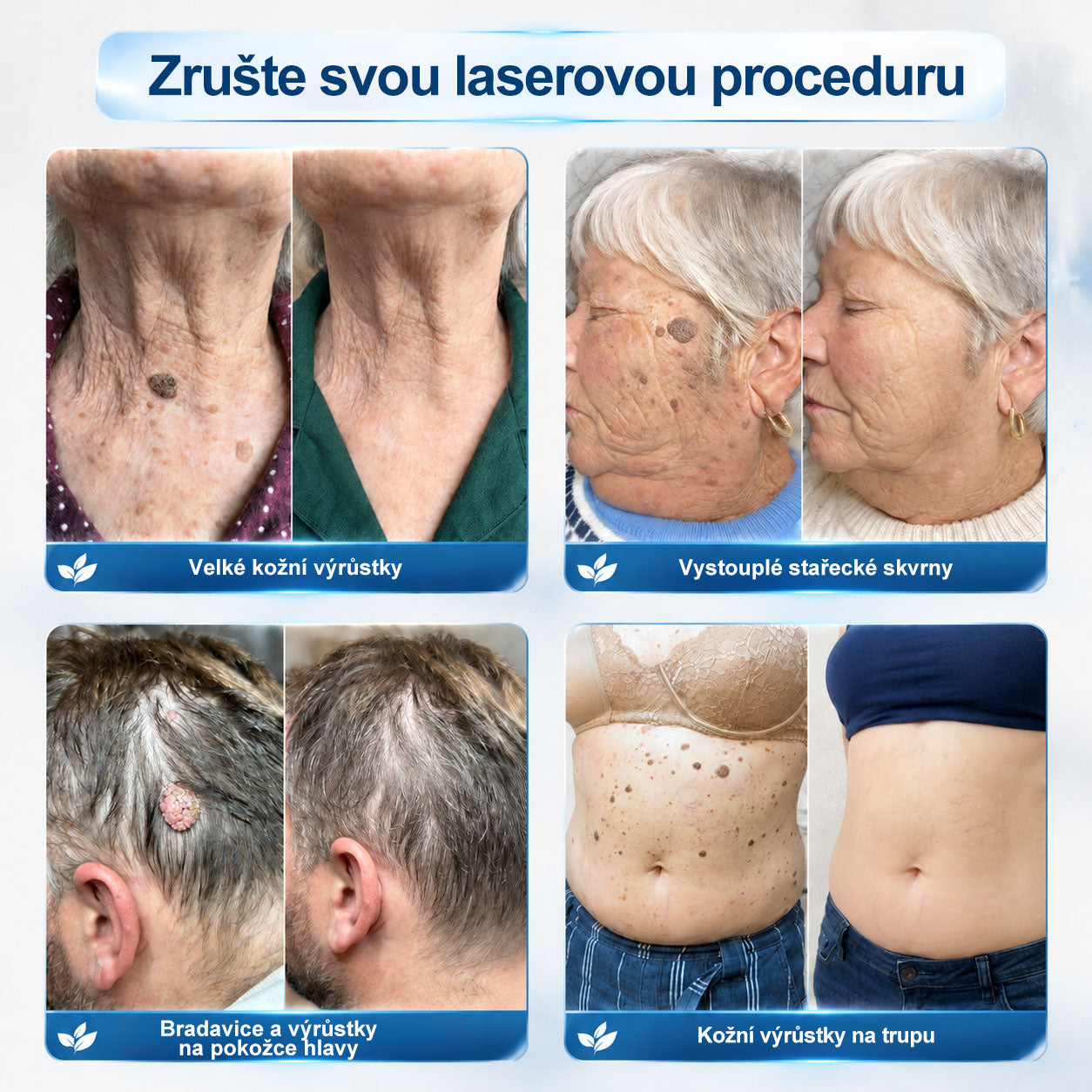Oficiální značkový obchod |👩‍⚕️𝐏𝐢𝐜𝑑𝑜® 𝟩𝖽𝖾𝗻𝗻í 𝘰𝘥𝘴𝘵𝗋𝖺ň𝗈𝗏𝖺č 𝒔𝒌𝒗𝒓𝙣 𝙖 𝙥𝙞𝙜𝙢𝙚𝙣𝙩𝘰𝘷ý𝘤𝘩 𝘴𝘬𝖛𝖗𝖓 (Bezbolestný rollerball bez jizev)🎉
