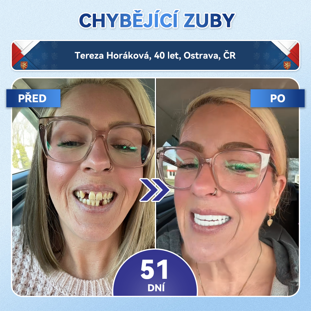 𝑮𝒍𝒊𝒎𝒎𝒆𝒓𝒍𝒚®🦷  𝑻𝒊𝒅𝒆𝒈𝒍𝒖𝒔𝒊𝒃 𝑴𝒊𝒄𝒓𝒐𝒏𝒆𝒆𝒅𝒍𝒆 𝑷𝒂𝒕𝒄𝒉 𝒏𝒂 𝒐𝒑𝒓𝒂𝒗𝒖 𝒛𝒖𝒃ů 𝒂 𝒅á𝒔𝒏í | Pokročilé náplasti pro aktivaci kmenových buněk zubů 👩‍⚕️ (Obnova zubní skloviny a dentinu • Posílení dásní • Odstranění zubního kamene a zápachu • Zastavení citlivosti zubů)💎