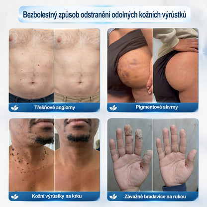 Oficiální značkový obchod |👩‍⚕️𝐏𝐢𝐜𝑑𝑜® 𝟩𝖽𝖾𝗻𝗻í 𝘰𝘥𝘴𝘵𝗋𝖺ň𝗈𝗏𝖺č 𝒔𝒌𝒗𝒓𝙣 𝙖 𝙥𝙞𝙜𝙢𝙚𝙣𝙩𝘰𝘷ý𝘤𝘩 𝘴𝘬𝖛𝖗𝖓 (Bezbolestný rollerball bez jizev)🎉
