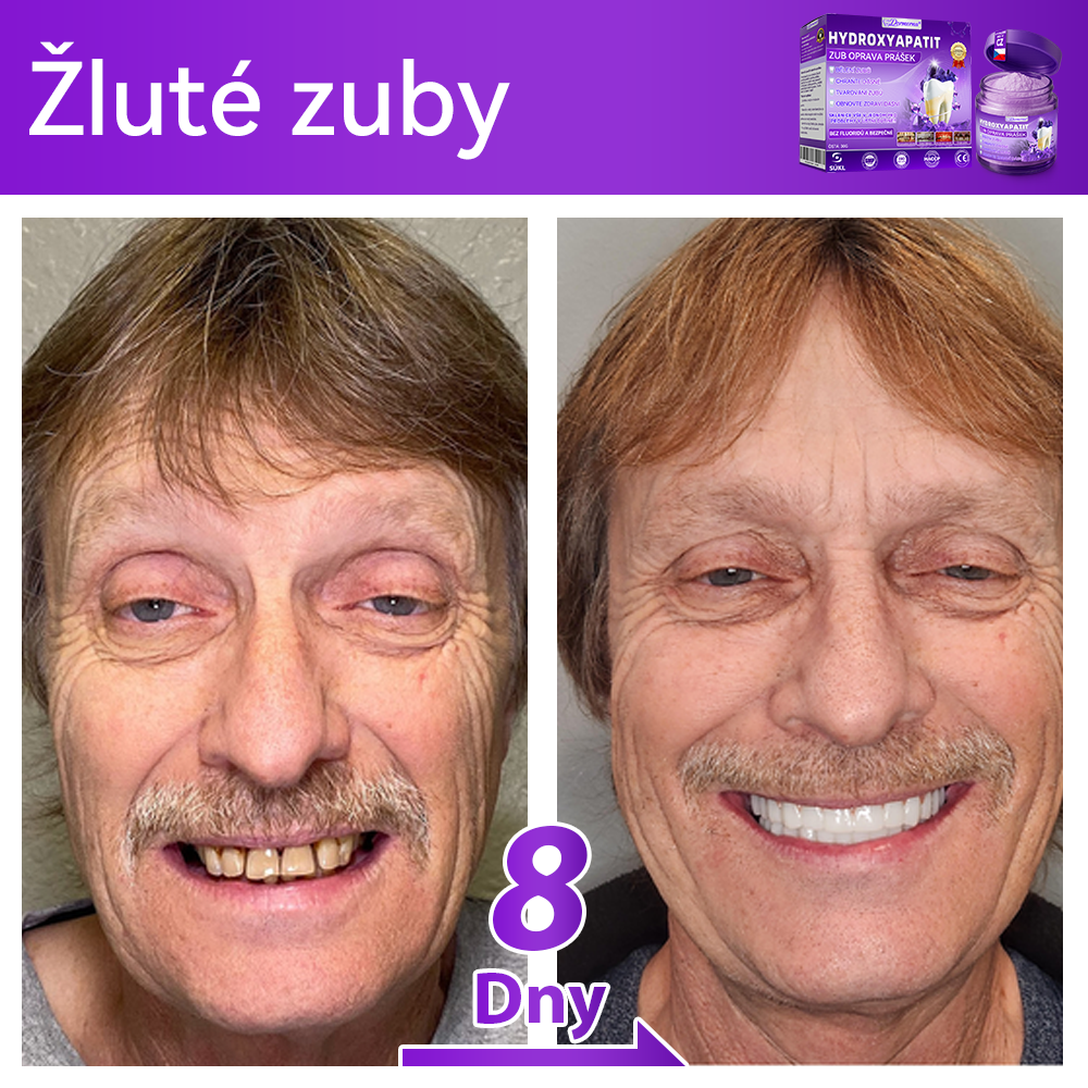 𝑫𝒐𝒓𝒎𝒐𝒓𝒏𝒂® Hydroxyapatit Zub Oprava Prášek✅Účinně léčí zubní kaz, problémy s dásněmi, citlivé zuby, afty a žluté zuby, zároveň zlepšuje celkové ústní zdraví.💎