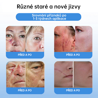 𝗹𝘂𝗸𝗺𝗹𝗰𝗮® 𝑪𝒐𝒐𝒍𝑬𝒓𝒂𝒔𝒆 𝒔𝒑𝒓𝒆𝒋 𝒑𝒓𝒐 𝒓𝒆𝒈𝒆𝒏𝒆𝒓𝒂𝒄𝒊 𝒑𝒐𝒌𝒐ž𝒌𝒚🌿 (𝐵𝑟𝑎𝑑𝑎𝑣𝑖𝑐𝑒, 𝑃𝑢𝑐ℎýř𝑒, 𝐸𝑘𝑧é𝑚, 𝐿𝑢𝑝𝑦, 𝐾𝑜ž𝑛í 𝑘𝑒𝑟𝑎𝑡ó𝑧𝑦, 𝐴𝑘𝑛é, 𝐾𝑜ž𝑛í 𝑣ý𝑟ů𝑠𝑡𝑘𝑦, 𝐽𝑖𝑧𝑣𝑦, 𝑀𝑎𝑡𝑒ř𝑠𝑘á 𝑧𝑛𝑎𝑚é𝑛𝑘𝑎)🔥