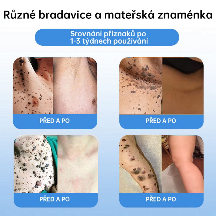 𝗹𝘂𝗸𝗺𝗹𝗰𝗮® 𝑪𝒐𝒐𝒍𝑬𝒓𝒂𝒔𝒆 𝒔𝒑𝒓𝒆𝒋 𝒑𝒓𝒐 𝒓𝒆𝒈𝒆𝒏𝒆𝒓𝒂𝒄𝒊 𝒑𝒐𝒌𝒐ž𝒌𝒚🌿 (𝐵𝑟𝑎𝑑𝑎𝑣𝑖𝑐𝑒, 𝑃𝑢𝑐ℎýř𝑒, 𝐸𝑘𝑧é𝑚, 𝐿𝑢𝑝𝑦, 𝐾𝑜ž𝑛í 𝑘𝑒𝑟𝑎𝑡ó𝑧𝑦, 𝐴𝑘𝑛é, 𝐾𝑜ž𝑛í 𝑣ý𝑟ů𝑠𝑡𝑘𝑦, 𝐽𝑖𝑧𝑣𝑦, 𝑀𝑎𝑡𝑒ř𝑠𝑘á 𝑧𝑛𝑎𝑚é𝑛𝑘𝑎)🔥