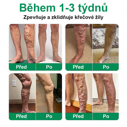 𝑻𝒘𝒊𝒔𝒎𝒂® 𝑽𝒆𝒊𝒏𝑻𝒂𝒓𝒈𝒆𝒕 – 𝑷𝒐𝒌𝒓𝒐č𝒊𝒍á 𝒎𝒊𝒌𝒓𝒐𝒋𝒆𝒉𝒍𝒊č𝒌𝒐𝒗á 𝒏á𝒑𝒍𝒂𝒔𝒕 𝒏𝒂 𝒌ř𝒆č𝒐𝒗é ží𝒍𝒚 💙 𝑽𝒊𝒅𝒊𝒕𝒆𝒍𝒏é 𝒗ý𝒔𝒍𝒆𝒅𝒌𝒚 𝒖ž 𝒛𝒂 7–14 𝒅𝒏í (𝑱𝒆𝒎𝒏á 𝒑𝒐𝒅𝒑𝒐𝒓𝒂 𝒑𝒓𝒐 𝒍𝒆𝒉čí 𝒂 𝒖𝒗𝒐𝒍𝒏ě𝒏ě𝒋ší 𝒏𝒐𝒉𝒚)👍
