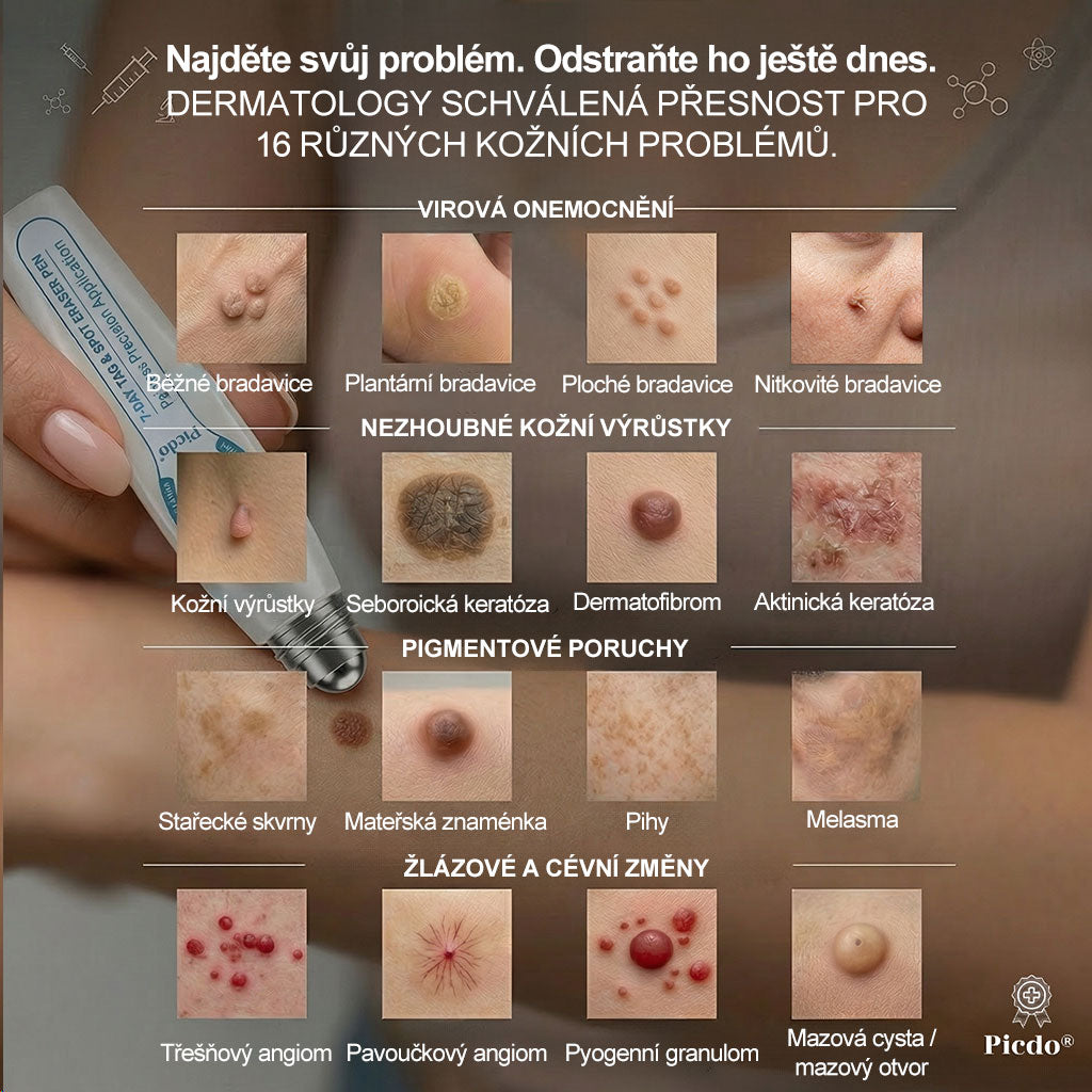 Oficiální značkový obchod |👩‍⚕️𝐏𝐢𝐜𝑑𝑜® 𝟩𝖽𝖾𝗻𝗻í 𝘰𝘥𝘴𝘵𝗋𝖺ň𝗈𝗏𝖺č 𝒔𝒌𝒗𝒓𝙣 𝙖 𝙥𝙞𝙜𝙢𝙚𝙣𝙩𝘰𝘷ý𝘤𝘩 𝘴𝘬𝖛𝖗𝖓 (Bezbolestný rollerball bez jizev)🎉
