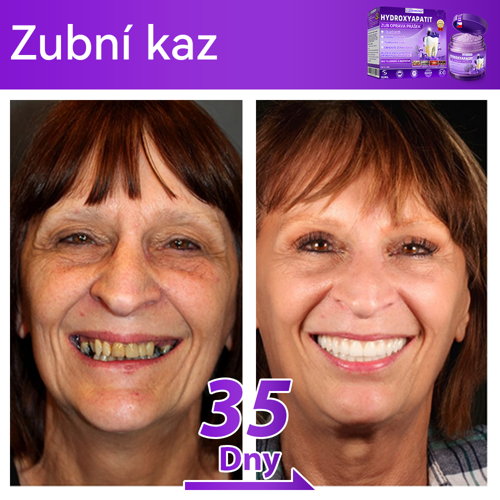 𝑫𝒐𝒓𝒎𝒐𝒓𝒏𝒂® Hydroxyapatit Zub Oprava Prášek✅Účinně léčí zubní kaz, problémy s dásněmi, citlivé zuby, afty a žluté zuby, zároveň zlepšuje celkové ústní zdraví.💎