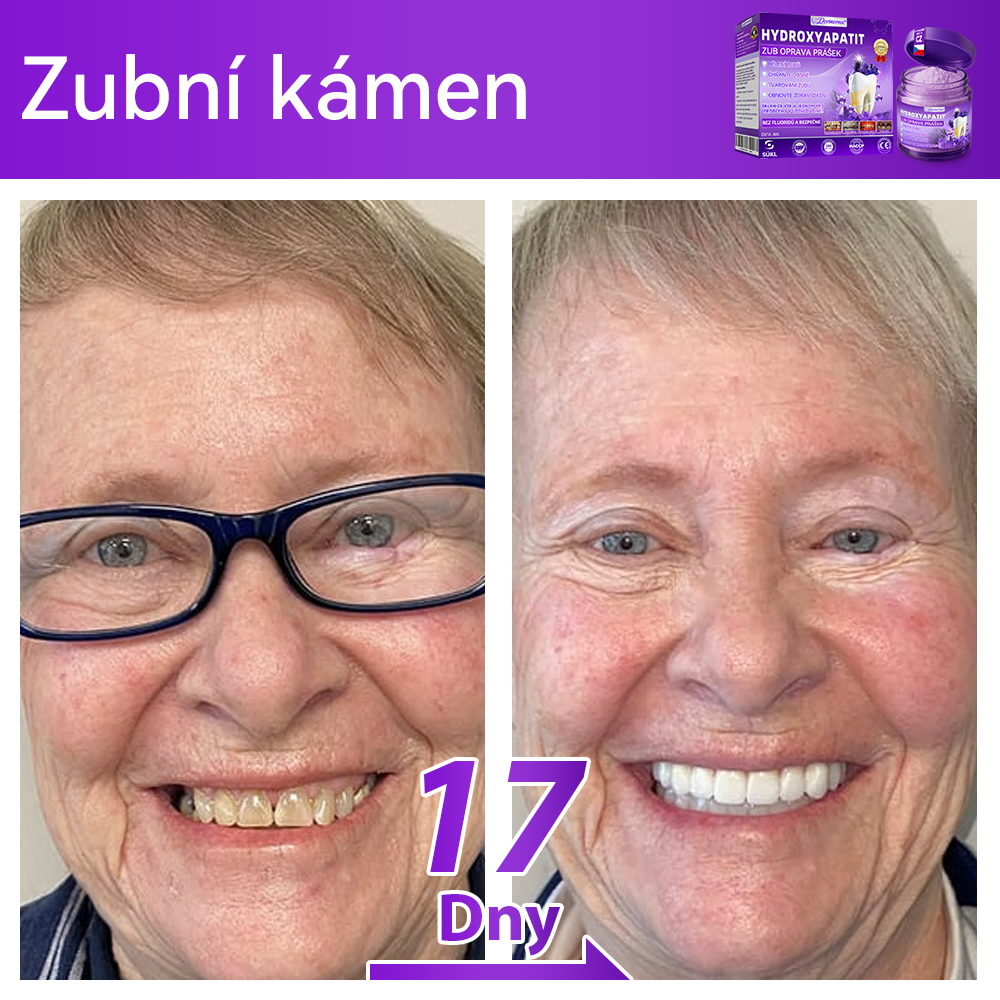 𝑫𝒐𝒓𝒎𝒐𝒓𝒏𝒂® Hydroxyapatit Zub Oprava Prášek✅Účinně léčí zubní kaz, problémy s dásněmi, citlivé zuby, afty a žluté zuby, zároveň zlepšuje celkové ústní zdraví.💎
