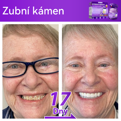 𝑫𝒐𝒓𝒎𝒐𝒓𝒏𝒂® Hydroxyapatit Zub Oprava Prášek✅Účinně léčí zubní kaz, problémy s dásněmi, citlivé zuby, afty a žluté zuby, zároveň zlepšuje celkové ústní zdraví.💎