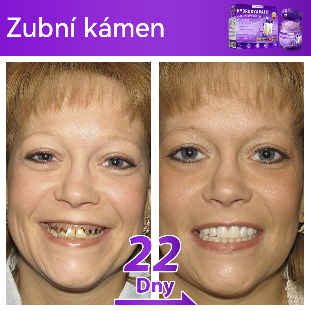 𝑫𝒐𝒓𝒎𝒐𝒓𝒏𝒂® Hydroxyapatit Zub Oprava Prášek✅Účinně léčí zubní kaz, problémy s dásněmi, citlivé zuby, afty a žluté zuby, zároveň zlepšuje celkové ústní zdraví.💎