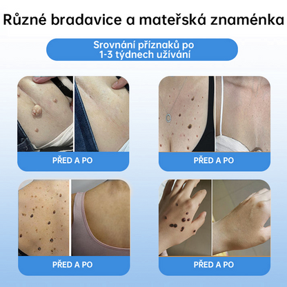 𝗹𝘂𝗸𝗺𝗹𝗰𝗮® 𝑪𝒐𝒐𝒍𝑬𝒓𝒂𝒔𝒆 𝒔𝒑𝒓𝒆𝒋 𝒑𝒓𝒐 𝒓𝒆𝒈𝒆𝒏𝒆𝒓𝒂𝒄𝒊 𝒑𝒐𝒌𝒐ž𝒌𝒚🌿 (𝐵𝑟𝑎𝑑𝑎𝑣𝑖𝑐𝑒, 𝑃𝑢𝑐ℎýř𝑒, 𝐸𝑘𝑧é𝑚, 𝐿𝑢𝑝𝑦, 𝐾𝑜ž𝑛í 𝑘𝑒𝑟𝑎𝑡ó𝑧𝑦, 𝐴𝑘𝑛é, 𝐾𝑜ž𝑛í 𝑣ý𝑟ů𝑠𝑡𝑘𝑦, 𝐽𝑖𝑧𝑣𝑦, 𝑀𝑎𝑡𝑒ř𝑠𝑘á 𝑧𝑛𝑎𝑚é𝑛𝑘𝑎)🔥