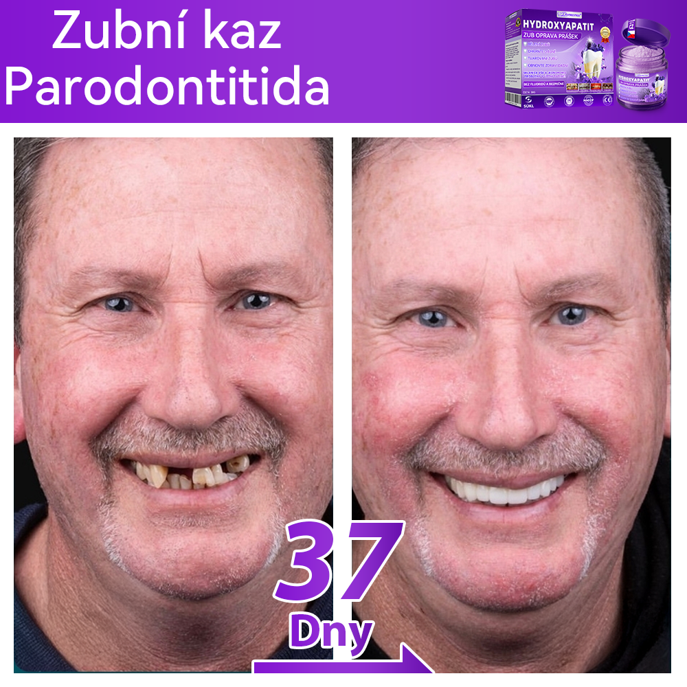 𝑫𝒐𝒓𝒎𝒐𝒓𝒏𝒂® Hydroxyapatit Zub Oprava Prášek✅Účinně léčí zubní kaz, problémy s dásněmi, citlivé zuby, afty a žluté zuby, zároveň zlepšuje celkové ústní zdraví.💎
