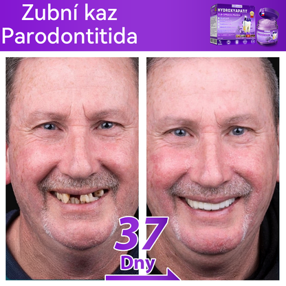𝑫𝒐𝒓𝒎𝒐𝒓𝒏𝒂® Hydroxyapatit Zub Oprava Prášek✅Účinně léčí zubní kaz, problémy s dásněmi, citlivé zuby, afty a žluté zuby, zároveň zlepšuje celkové ústní zdraví.💎