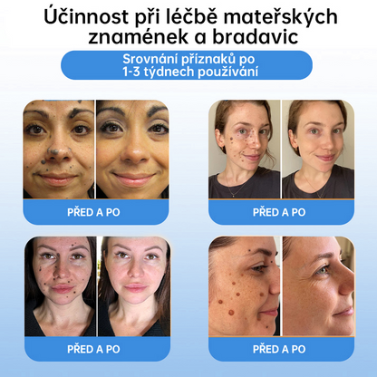 𝗹𝘂𝗸𝗺𝗹𝗰𝗮® 𝑪𝒐𝒐𝒍𝑬𝒓𝒂𝒔𝒆 𝒔𝒑𝒓𝒆𝒋 𝒑𝒓𝒐 𝒓𝒆𝒈𝒆𝒏𝒆𝒓𝒂𝒄𝒊 𝒑𝒐𝒌𝒐ž𝒌𝒚🌿 (𝐵𝑟𝑎𝑑𝑎𝑣𝑖𝑐𝑒, 𝑃𝑢𝑐ℎýř𝑒, 𝐸𝑘𝑧é𝑚, 𝐿𝑢𝑝𝑦, 𝐾𝑜ž𝑛í 𝑘𝑒𝑟𝑎𝑡ó𝑧𝑦, 𝐴𝑘𝑛é, 𝐾𝑜ž𝑛í 𝑣ý𝑟ů𝑠𝑡𝑘𝑦, 𝐽𝑖𝑧𝑣𝑦, 𝑀𝑎𝑡𝑒ř𝑠𝑘á 𝑧𝑛𝑎𝑚é𝑛𝑘𝑎)🔥